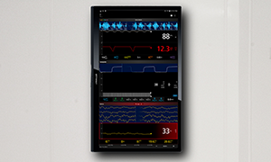 Kite® Supplemental Display